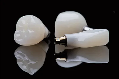 Dental Implants By Tan Khuu