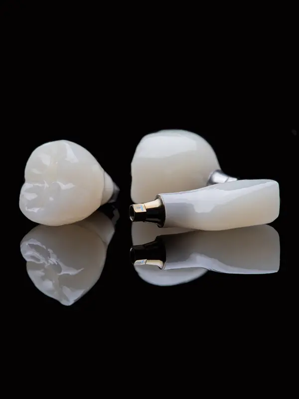 Dental Implants By Tan Khuu, DDS