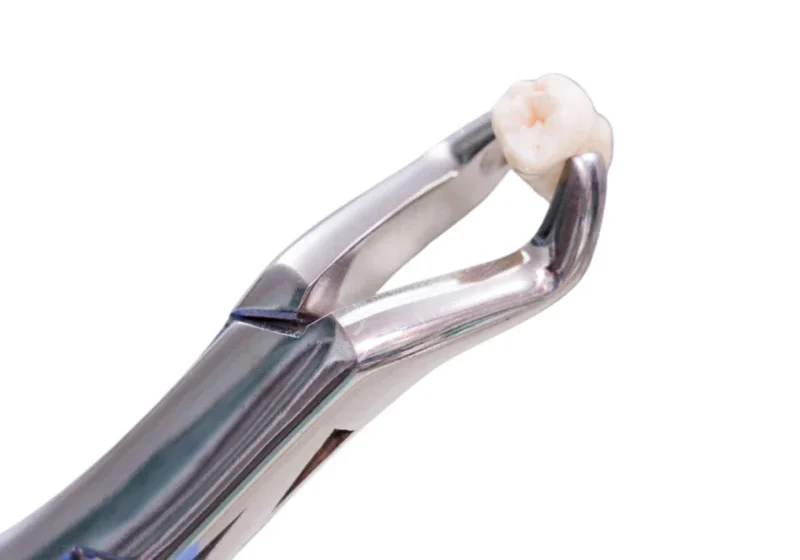 Gentle Tooth Extraction