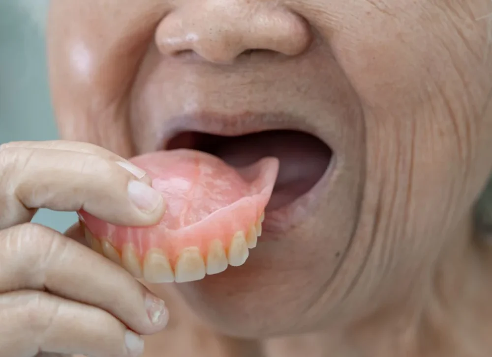 Older lady with dentures