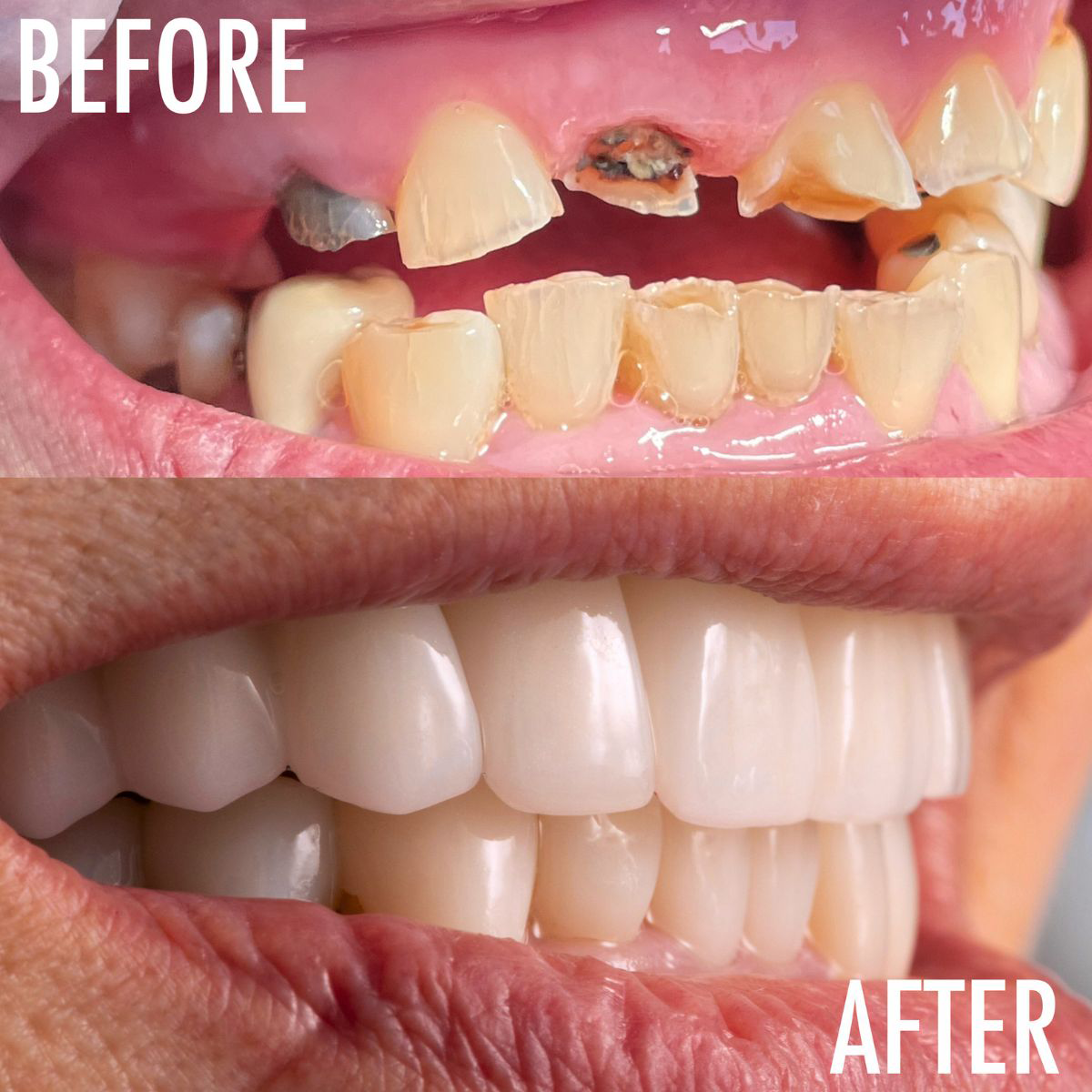 Oral Surgery Before And After