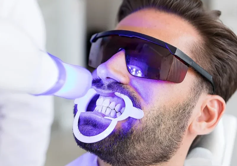 Patient Getting Professional Teeth Whitening Service
