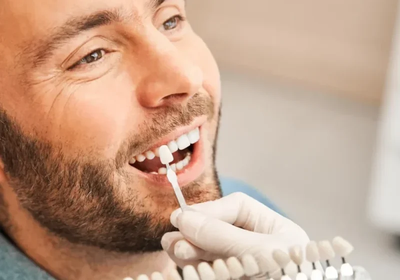 Porcelain Veneers Patient