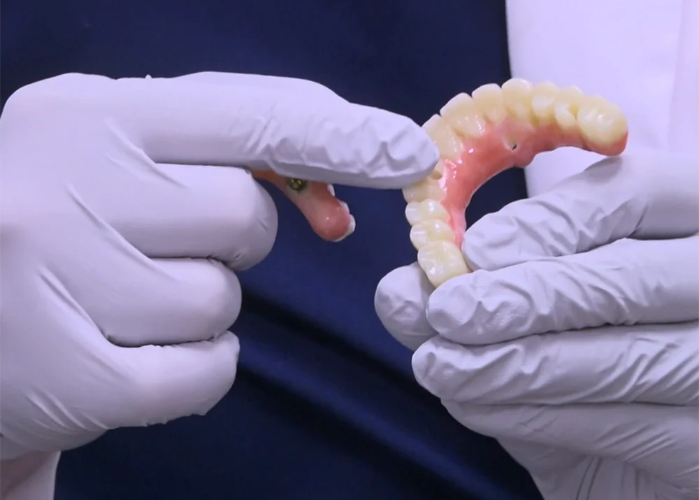 Dr. Khuu Holding Full Arch Dental Implant
