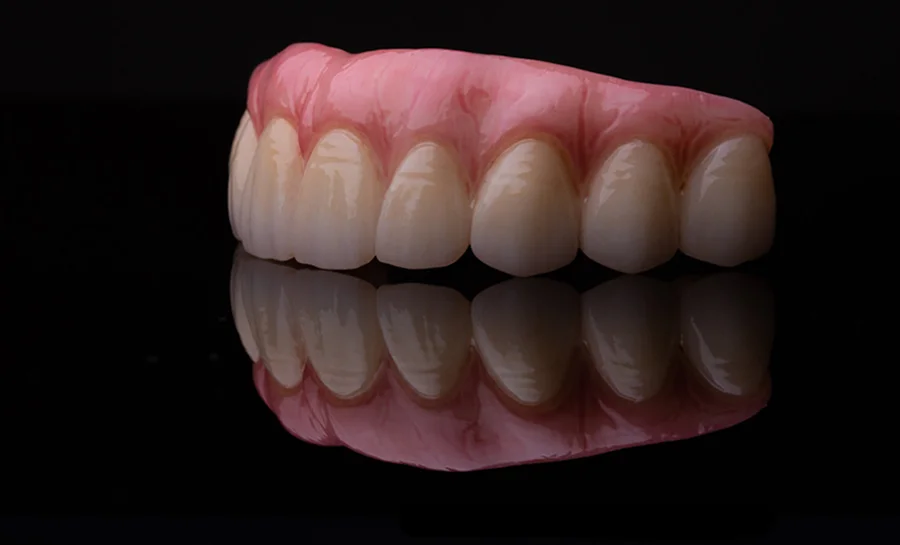 Garden Grove Full Mouth Dental Implants Arch By Tan Khuu DDS