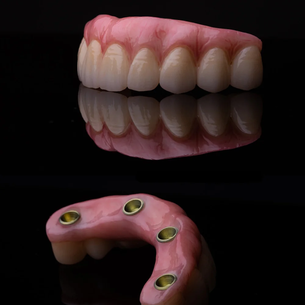 Garden Grove Full Mouth Dental Implants Arch By Tan Khuu, DDS